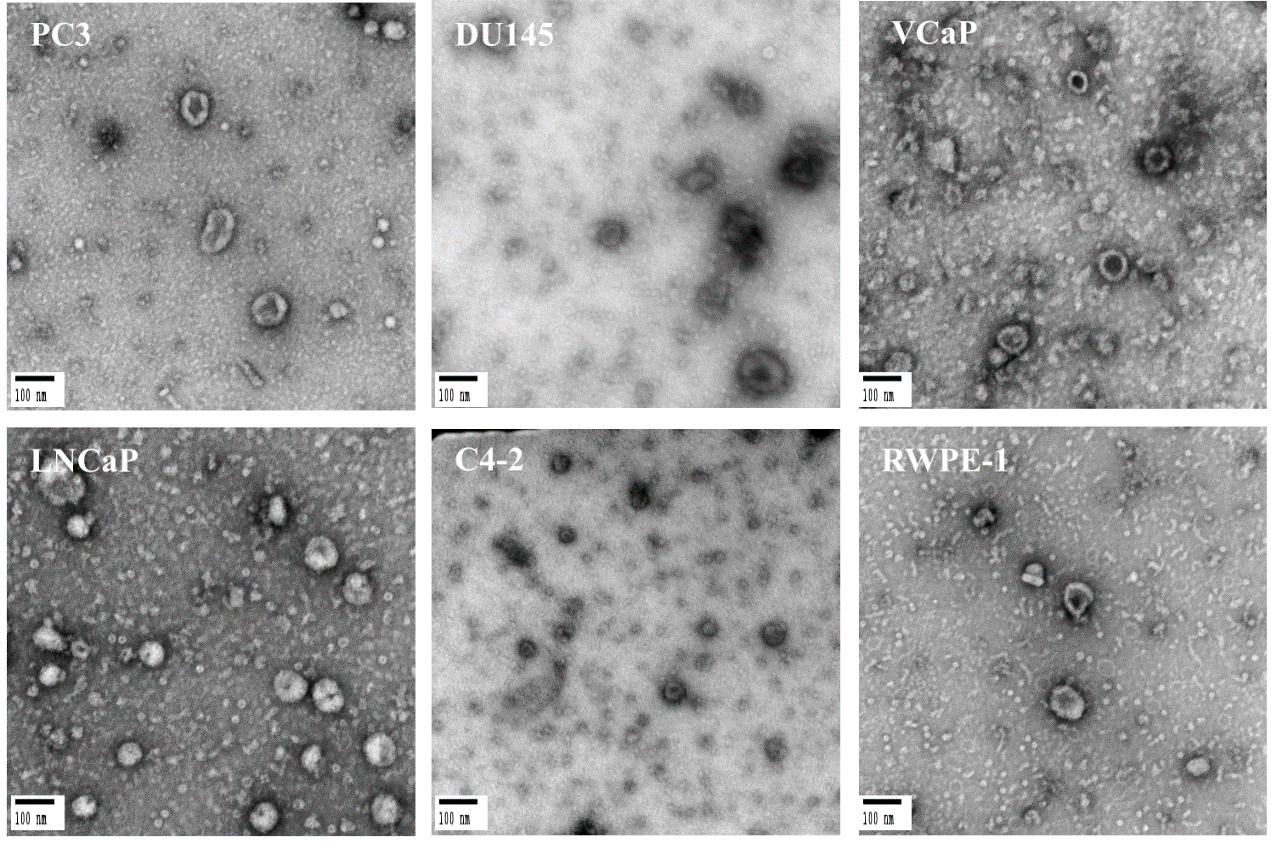 文献中外泌体在电镜tem模式下的经典形态